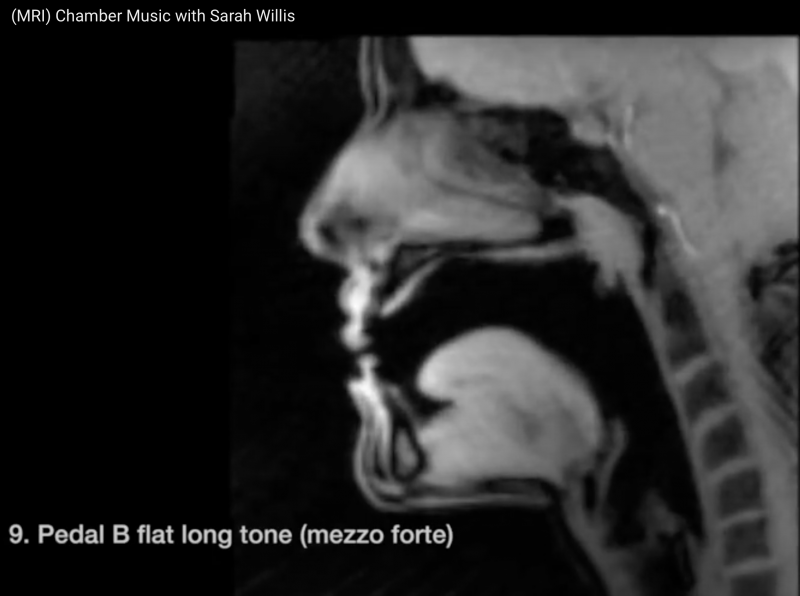 Datei:Sarah Willis MRI Aufnahmen.png